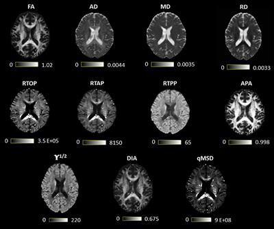 Viability of AMURA biomarkers from single-shell diffusion MRI in clinical studies